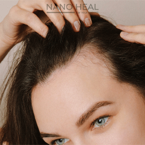 What-hair-serum-should-I-use-to-completely-stop-hair-loss-min
