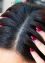Traditional-methods-of-treating-hair-loss-and-dandruff-min