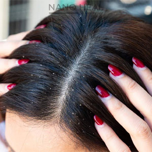 Traditional-methods-of-treating-hair-loss-and-dandruff-min